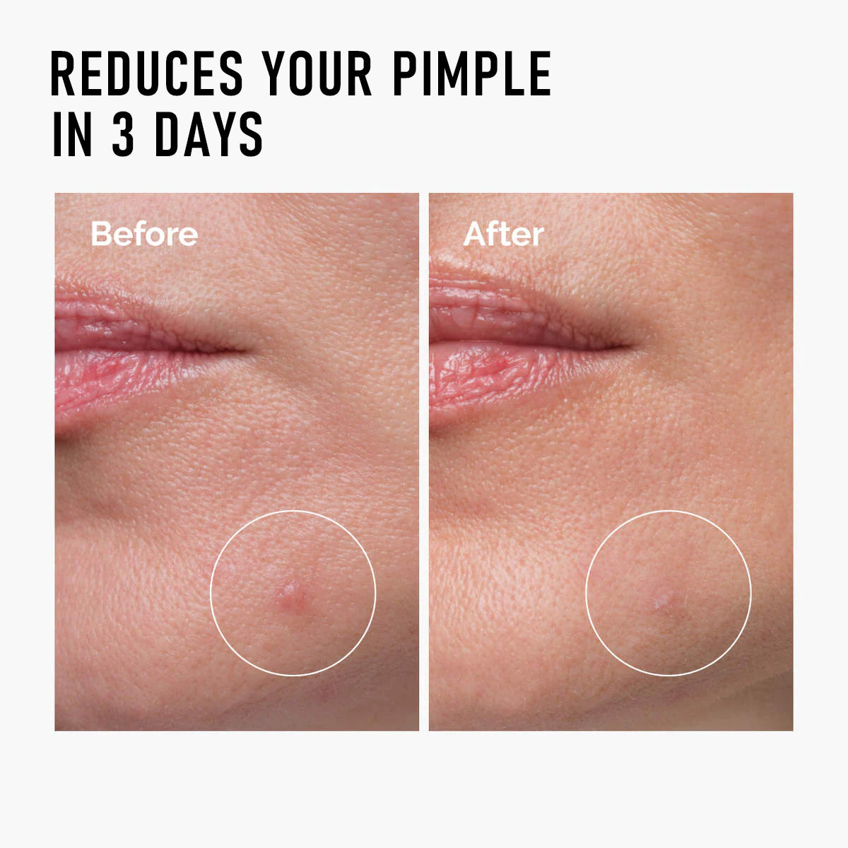 Esencia para piel con imperfecciones C-S002