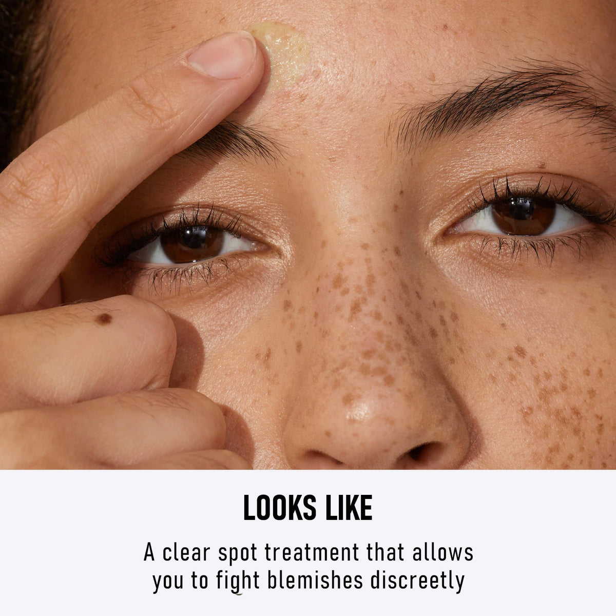 Esencia para piel con imperfecciones C-S002